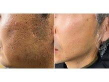 ネモト ヘアーサロンの雰囲気（メンズエステあり◎角質を取り除き1年ホームケアするとキメ整う）
