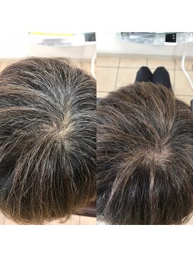 あさひ 白髪染めのループから開放する新しい白髪を活かすカラー　1