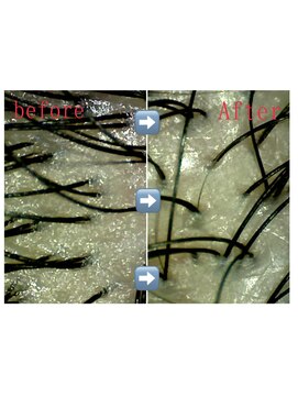 オリーブ 南森町店(Olive) 【下矢】頭皮洗浄