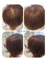 ユーフォルムギンザ(y-Forme Ginza)&nbsp;話題のトキカタ♪頭頂部編