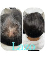 ラソヘアー(Lazo hair) かつらメンテナンス