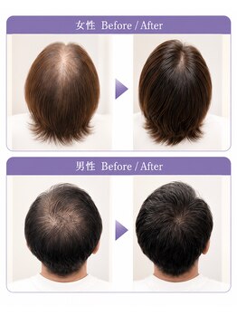ビビデココ(ViVi de CoCo)の写真/最先端＊髪を育むCR（セレブリボーン）3STEP頭皮ケア