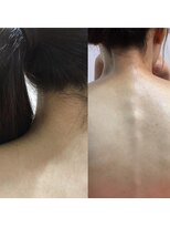 ビービータカオカ(B B TAKAOKA)&nbsp;ブライダルシェービング