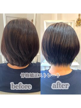 骨格矯正ストレート　耳掛けショート