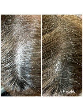 アイビー(IVY) オレンジ撃退の白髪ボカシ［髪質改善/縮毛矯正/ヘナ/千葉駅］