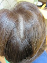 ヨシユキコンディショニング&nbsp;エイジレス　特許「つむじ補正」　つむじ、分け目が目立つ方４８