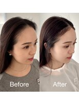 ソラ 表参道(SORA)&nbsp;韓国式！チャンモリパーマ、うぶ毛パーマで小顔に！