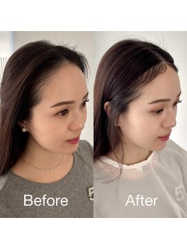 ソラ 表参道(SORA) 韓国式!チャンモリパーマ、うぶ毛パーマで小顔に!