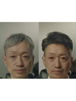 お客様に寄り添った丁寧なカウンセリングで、お悩みやご要望をしっかりと汲み取り最適な施術をご提案＊