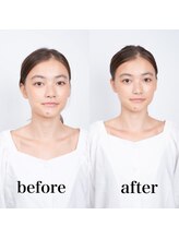 ビフォー&アフター