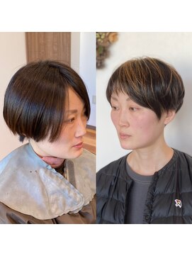 ロトヘアー(Roto hair) お客様Before&After 【Roto hair】