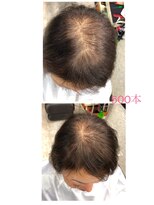 ヘアーメイクボヌール(hair make Bonheur)&nbsp;フォルムファンデーション500本