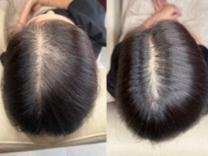 増毛エクステ専門店 頭皮ケアサロン fleurの写真