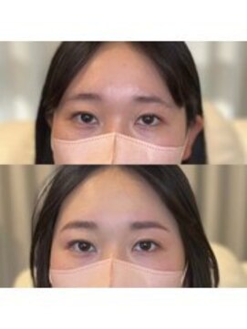 ラストーリア(La storia) 下がり眉を改善。垢抜け眉毛ワックス