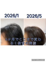 シュガーレジュ(sugarreju)&nbsp;【70代の根育成果】細毛・トップの立ち上がり・髪艶のお悩みに◎