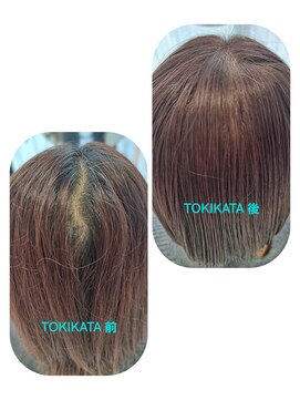 ユーフォルムギンザ(y-Forme Ginza) TOKIKATA(トキカタ)で悩み解消♪