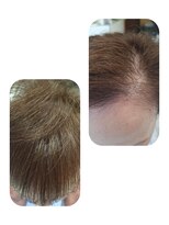 ユーフォルムギンザ(y-Forme Ginza)&nbsp;話題のトキカタ♪前髪編