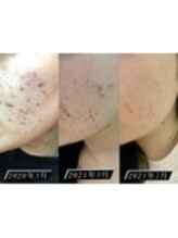 しっかり結果が出る！…大人気『CLALAシリーズ』