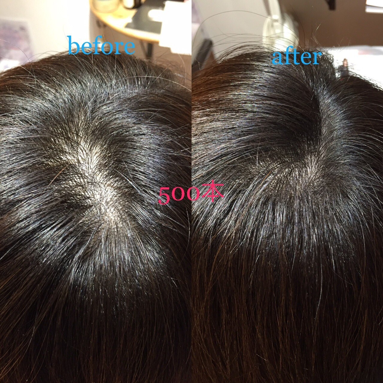 増毛エクステ 500本 ふんわりナチュラル黒髪暗髪：L201003373｜カラー