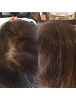 カラーワールド カンナヘアーメゾン(color world canna hair maison)&nbsp;増毛エクステ 頭頂部 ふんわりナチュラルブラウン