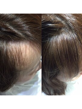 カラーワールド カンナヘアーメゾン(color world canna hair maison) 増毛エクステ 生え際 ふんわりナチュラル暗髪ブラウン