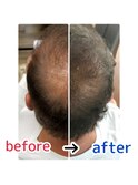 頭皮改善！育毛促進ケア！