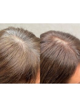 気になり始めた白髪も自然な仕上がりに♪明るく染まる白髪染めで、今までとは違うお洒落な仕上がりに。