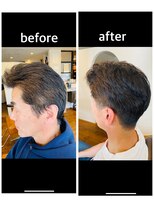 ユルリィ(yururie)&nbsp;紳士的育毛カット