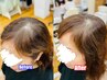 【新大久保】増 毛 エクステ【M字分かれが気になる人向け】200本コース