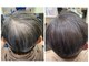 育毛促進・頭皮改善専門サロン Hair Make Aesopの写真/【結果重視の方へ◎】本気の育毛促進メニュー*身だしなみを左右する頭皮に徹底アプローチしたご提案◎