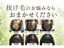 フォレスト(forest)の雰囲気（抜け毛でお困りの方悩んでる方おまかせ下さい/育毛促進/抜け毛/）