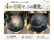 ヘアディボーション(HairDevotion)の雰囲気（頭皮診断×スカルプクレンジング×LLLTで、育毛を促すケア）