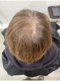 脱白髪染め（before）