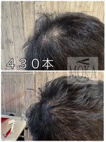 ヘアーサロン モカ(Hair salon MOKA) 特許増毛エクステ