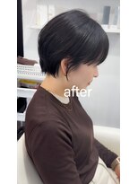 ライラ(LAILA) Before after
