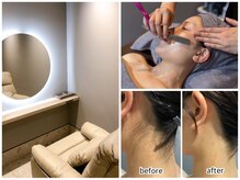 完全個室レディースシェービング[襟足・ブライダルシェービング]