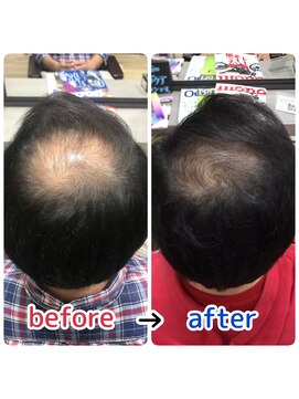 ブルーフィン シセロ(Blue Fin cicero) 頭皮改善！育毛促進ケア