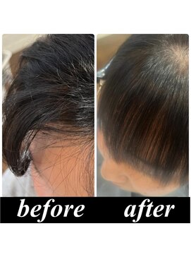 ウィル ボッサ 御茶ノ水 神保町(WILL bossa) 【美髪整形】異次元の髪質改善☆シルク酸性ストレート前髪