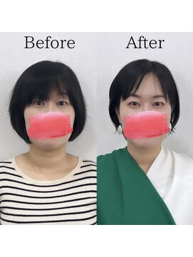 レトア(Letoa) ビフォーアフター