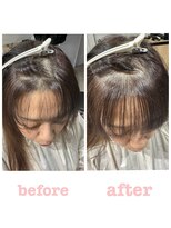 ストップアリトル(stop a little)&nbsp;ヒートエンジェリックケア