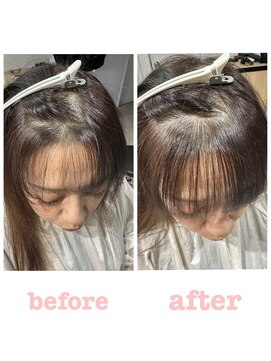 ストップアリトル(stop a little) ヒートエンジェリックケア