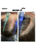 頭皮改善エステ　before　after