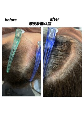 髪質改善 ソアリス 烏丸丸太町店(soiris) 頭皮改善エステ　before　after