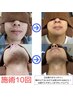 メンズ　顔アゴ下～頬まで顔全体　光ヒゲ　脱　毛　コース￥5990