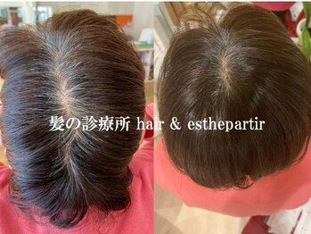 パルティール(Partir)の写真/【感動の口コミ多数!髪の病院最高峰髪質改善カラーを!】頭皮、髪のダメージ、経皮吸収ほぼ無し！