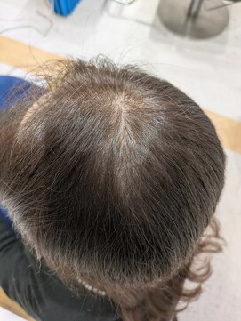 白髪比率40％☆白髪染めでも透明感のあるミルクティーベージュ