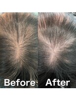 ツムグ 代官山 中目黒(TUMUGU)&nbsp;前髪割れ・地肌見え解消/ボリュームアップエクステ