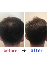 ブルーフィン シセロ(Blue Fin cicero) 頭皮改善!育毛促進ケア!