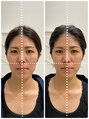 ハルキミナトジャパン ヒロシマ(HARUKI MINATO japan HIROSHIMA)&nbsp;広島で唯一の骨格補正スパ技術者です！バランス小顔に♪
