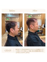 グランバイ アトリエドングリ(Grand × AtlierDonguri)&nbsp;お客様髪質改善データ1957（猫っ毛の男性対策）